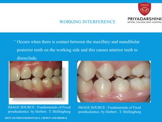Tooth Disocclude Occlusion of fixed bridges and crowns dentistry | PPTX