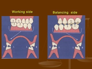 Dental Occlusion | PPT