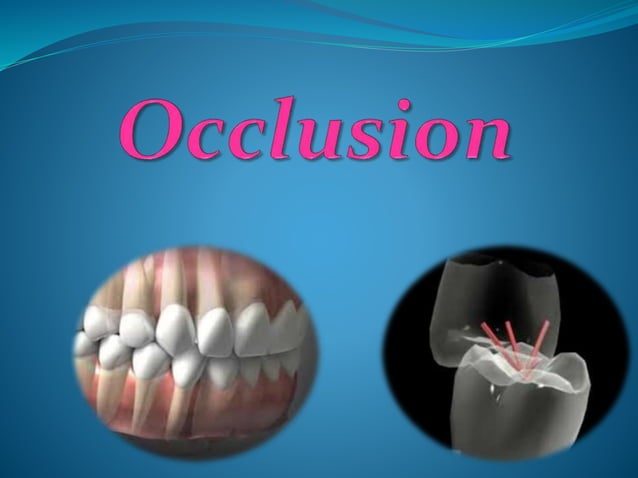 Occlusion 2017 | PPT