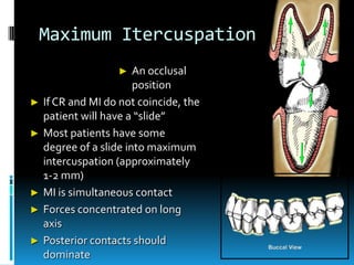 Occlusion and tmd | PPTX