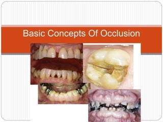 Basic Concepts Of Occlusion
 