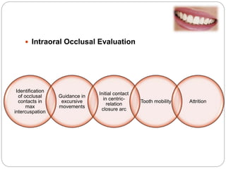 Occlusion basic | PPTX