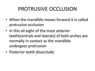 Tooth Disocclude Occlusion dr jameel demonstration | PPTX