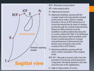 Chewing stroke 
Anterior opening 
border 
Sagittal view 
 