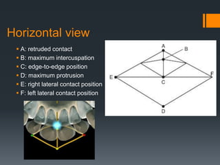 Horizontal view 
 A: retruded contact 
 B: maximum intercuspation 
 C: edge-to-edge position 
 D: maximum protrusion 
 E: right lateral contact position 
 F: left lateral contact position 
F 
 