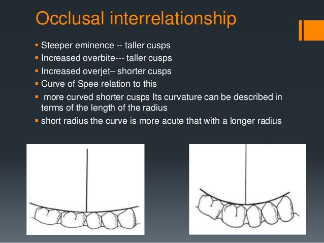 Occlusion for prosthodontics posselt s diagram 