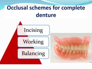 Occlusal schemes for complete
denture
Incising
Working
Balancing
 
