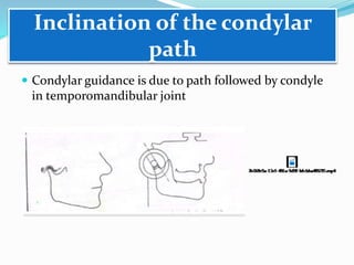 Inclination of the condylar
path
 Condylar guidance is due to path followed by condyle
in temporomandibular joint
 