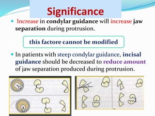 Significance
 Increase in condylar guidance will increase jaw
separation during protrusion.
 In patients with steep condylar guidance, incisal
guidance should be decreased to reduce amount
of jaw separation produced during protrusion.
this factore cannot be modified
 