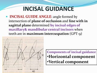 INCISAL GUIDANCE
 INCISAL GUIDE ANGLE: angle formed by
intersection of plane of occlusion and line with in
sagittal plane determined by incisal edges of
maxillary& mandibular central incisors when
teeth are in maximum intercuspation (GPT-9)
Components of incisal guidance
•Horizontal component
•Vertical component
 