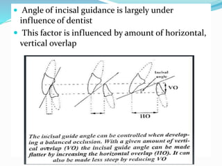  Angle of incisal guidance is largely under
influence of dentist
 This factor is influenced by amount of horizontal,
vertical overlap
 