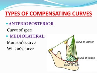 TYPES OF COMPENSATING CURVES
 ANTERIOPOSTERIOR
Curve of spee
 MEDIOLATERAL:
Monson’s curve
Wilson’s curve
 