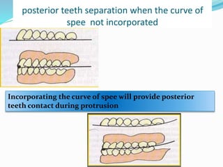 posterior teeth separation when the curve of
spee not incorporated
Incorporating the curve of spee will provide posterior
teeth contact during protrusion
 