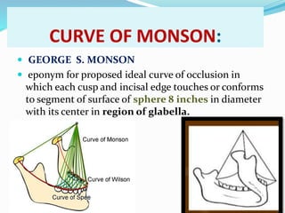 CURVE OF MONSON:
 GEORGE S. MONSON
 eponym for proposed ideal curve of occlusion in
which each cusp and incisal edge touches or conforms
to segment of surface of sphere 8 inches in diameter
with its center in region of glabella.
 