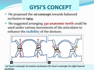 GYSI’S CONCEPT
 He proposed the 1st concept towards balanced
occlusion in 1914.
 He suggested arranging 330 anatomic teeth could be
used under various movements of the articulator to
enhance the stability of the denture.
(a) Gysi's concept: In centric occlusion (b) Gysi's concept: In right lateral
position
 