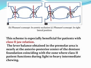 (b) Pleasure's concept: In centric occlusion (c) Pleasure's concept: In right
lateral position
This scheme is especially beneficial for patients with
class II jaw relation.
The lever balance obtained in the premolar area is
nearly at the anterio-posterior center of the denture
foundation coinciding with the zone where class II
patient functions during light to heavy intermediate
chewing.
 