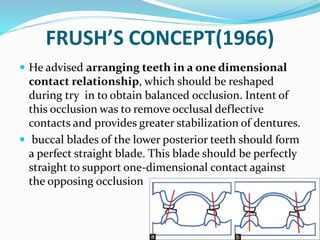 FRUSH’S CONCEPT(1966)
 He advised arranging teeth in a one dimensional
contact relationship, which should be reshaped
during try in to obtain balanced occlusion. Intent of
this occlusion was to remove occlusal deflective
contacts and provides greater stabilization of dentures.
 buccal blades of the lower posterior teeth should form
a perfect straight blade. This blade should be perfectly
straight to support one-dimensional contact against
the opposing occlusion
 