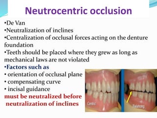 Neutrocentric occlusion
•De Van
•Neutralization of inclines
•Centralization of occlusal forces acting on the denture
foundation
•Teeth should be placed where they grew as long as
mechanical laws are not violated
•Factors such as
• orientation of occlusal plane
• compensating curve
• incisal guidance
must be neutralized before
neutralization of inclines
 