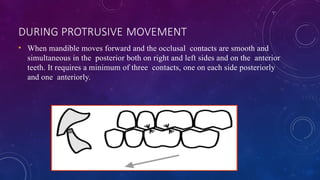 Proclusive Occlusion in complete denture-1.pptx occlusion | PPTX