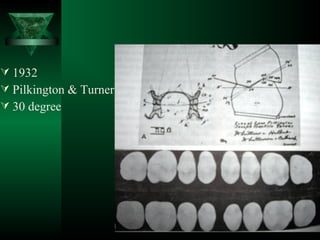  1932
 Pilkington & Turner
 30 degree
 