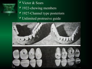  Victor & Sears
 1922-chewing members
 1927-Channel type posteriors
 Unlimited protrusive guide
 