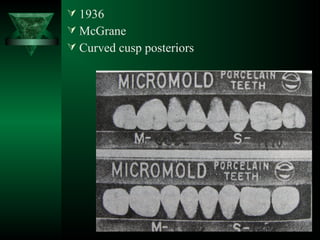  1936
 McGrane
 Curved cusp posteriors
 