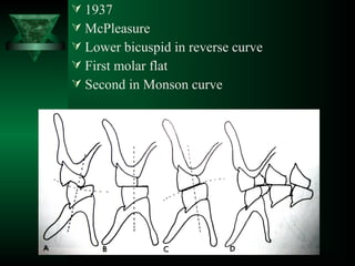  1937
 McPleasure
 Lower bicuspid in reverse curve
 First molar flat
 Second in Monson curve
 