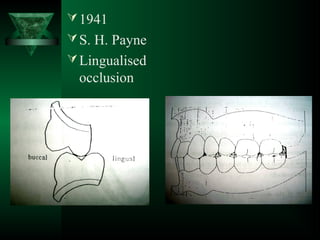 1941
S. H. Payne
Lingualised
occlusion
 