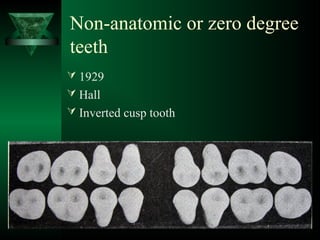Non-anatomic or zero degree
teeth
 1929
 Hall
 Inverted cusp tooth
 