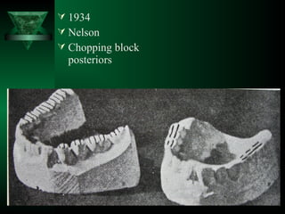  1934
 Nelson
 Chopping block
posteriors
 