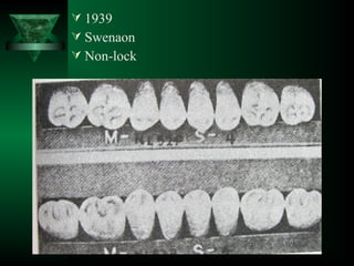  1939
 Swenaon
 Non-lock
 