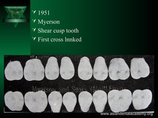  1951
 Myerson
 Shear cusp tooth
 First cross lnnked
www.asiandentalacademy.orgwww.asiandentalacademy.org
 