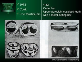  1952
 Cook
 Coe Masticators
1957
Cutter bar
Upper porcelain cuspless teeth
with a metal cutting bar
www.asiandentalacademy.orgwww.asiandentalacademy.org
 
