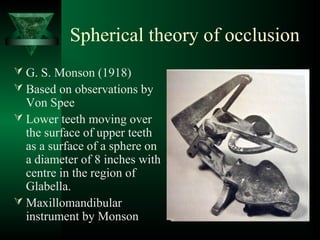 Spherical theory of occlusion
 G. S. Monson (1918)
 Based on observations by
Von Spee
 Lower teeth moving over
the surface of upper teeth
as a surface of a sphere on
a diameter of 8 inches with
centre in the region of
Glabella.
 Maxillomandibular
instrument by Monson
 