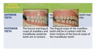 OCCLUSION IN COMPLETE DENTURE presentation.pptx