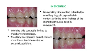 OCCLUSION IN COMPLETE DENTURE presentation.pptx