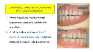 Maxillary Ramps OCCLUSION IN COMPLETE DENTURE presentation.pptx