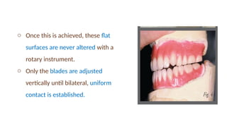 o Once this is achieved, these flat
surfaces are never altered with a
rotary instrument.
o Only the blades are adjusted
vertically until bilateral, uniform
contact is established.
 