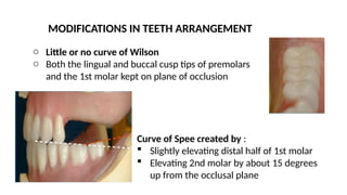 MODIFICATIONS IN TEETH ARRANGEMENT
o Little or no curve of Wilson
o Both the lingual and buccal cusp tips of premolars
and the 1st molar kept on plane of occlusion
o Curve of Spee created by :
 Slightly elevating distal half of 1st molar
 Elevating 2nd molar by about 15 degrees
up from the occlusal plane
 