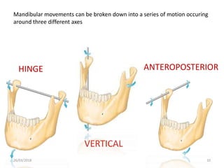 OCCLUSION IN COMPLETE DENTURES.pptx