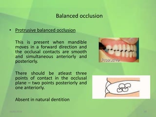 Proclusive OCCLUSION IN COMPLETE DENTURES.pptx