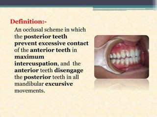 Definition:-
An occlusal scheme in which
the posterior teeth
prevent excessive contact
of the anterior teeth in
maximum
intercuspation, and the
anterior teeth disengage
the posterior teeth in all
mandibular excursive
movements.
 