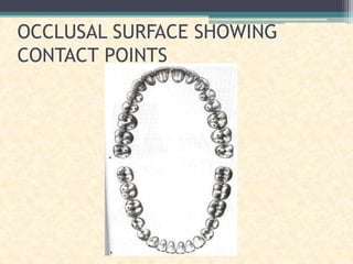 OCCLUSAL SURFACE SHOWING
CONTACT POINTS
 