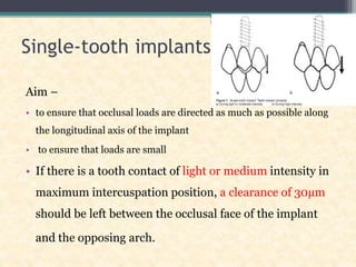 Single-tooth implants
Aim –
• to ensure that occlusal loads are directed as much as possible along
the longitudinal axis of the implant
• to ensure that loads are small
• If there is a tooth contact of light or medium intensity in
maximum intercuspation position, a clearance of 30µm
should be left between the occlusal face of the implant
and the opposing arch.
 