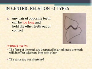 IN CENTRIC RELATION -3 TYPES
1. Any pair of opposing teeth
can be too long and
hold the other teeth out of
contact
CORRECTION-
• The fossa of the teeth are deepened by grinding so the teeth
will ,in effect telescope into each other.
• The cusps are not shortened
 