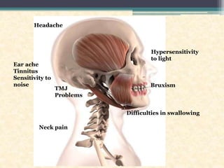 Hypersensitivity
to light
Headache
Ear ache
Tinnitus
Sensitivity to
noise
TMJ
Problems
Neck pain
Difficulties in swallowing
Bruxism
 