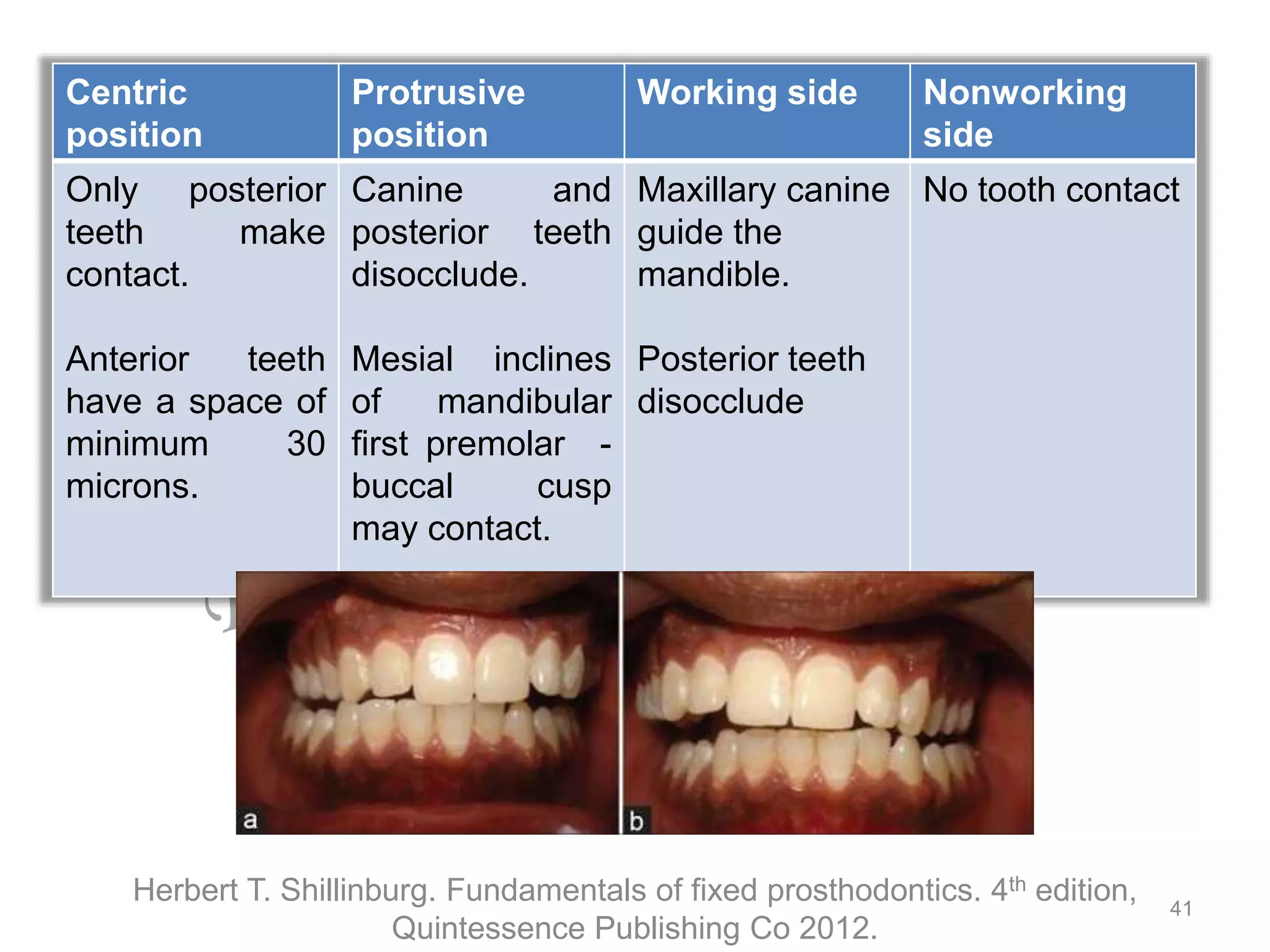 Occlusion in Fixed Dental Prosthesis | PPTX