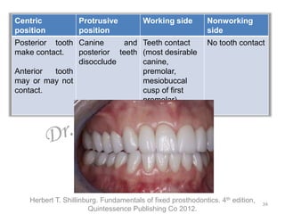 Tooth Disocclude Occlusion in Fixed Dental Prosthesis | PPTX