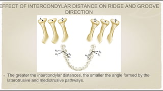 Intercondylar Distance Brain Occlusion in fixed partial denture | PPTX