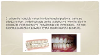 Tooth Disocclude Occlusion in fixed partial denture | PPTX